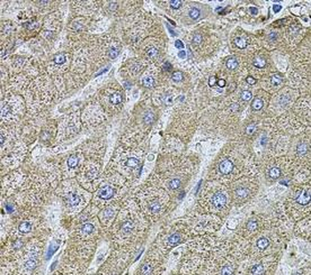 FLNB Rabbit Polyclonal Antibody