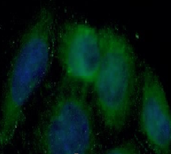 FOLR1 Rabbit Polyclonal Antibody