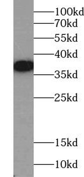 FOLR1 Rabbit Polyclonal Antibody
