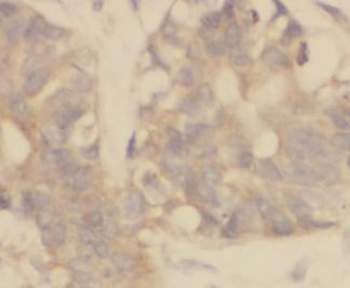 FOLR1 Rabbit Polyclonal Antibody