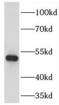FOXA1 Rabbit Polyclonal Antibody