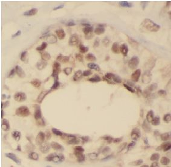 FOXA1 Rabbit Polyclonal Antibody
