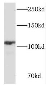 FOXM1 Rabbit Polyclonal Antibody