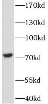FOXO6 Rabbit Polyclonal Antibody