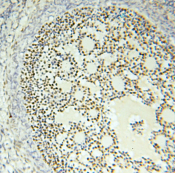 FOXP4 Rabbit Polyclonal Antibody