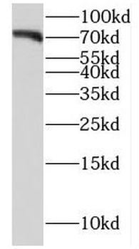 FZD8 Rabbit Polyclonal Antibody