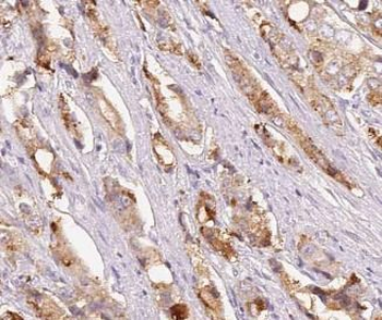 FRS2 Rabbit Polyclonal Antibody