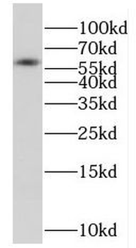 FSD1L Rabbit Polyclonal Antibody