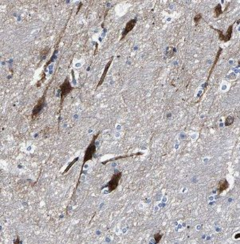 FSD1L Rabbit Polyclonal Antibody