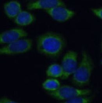 FSHR Rabbit Polyclonal Antibody