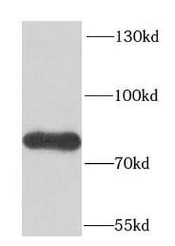 FUBP1 Rabbit Polyclonal Antibody