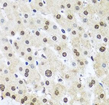 FUBP1 Rabbit Polyclonal Antibody