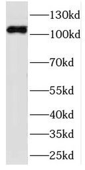 FCSK Rabbit Polyclonal Antibody