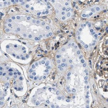 FCSK Rabbit Polyclonal Antibody