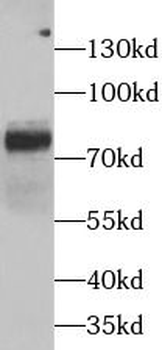 FURIN Rabbit Polyclonal Antibody