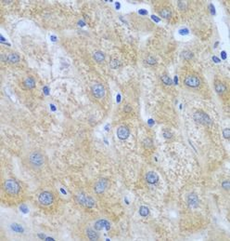 FURIN Rabbit Polyclonal Antibody