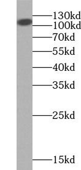 FUT4 Rabbit Polyclonal Antibody