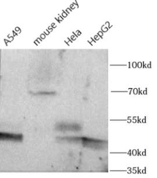 FUT8 Rabbit Polyclonal Antibody