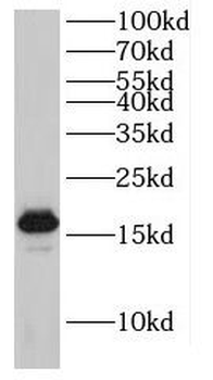 GABARAPL1 Rabbit Polyclonal Antibody