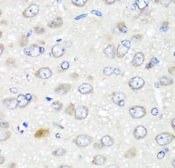 GABARAPL2 Rabbit Polyclonal Antibody