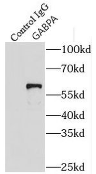 GABPA Rabbit Polyclonal Antibody