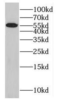 GABPA Rabbit Polyclonal Antibody