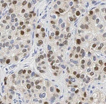 GABPA Rabbit Polyclonal Antibody