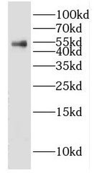 GABRA1 Rabbit Polyclonal Antibody