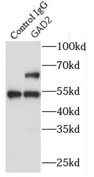 GAD2 Rabbit Polyclonal Antibody