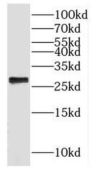 GADD45GIP1 Rabbit Polyclonal Antibody