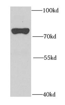 GALC Rabbit Polyclonal Antibody