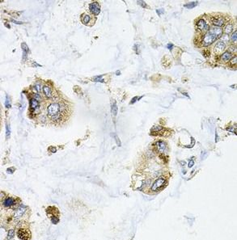 GALC Rabbit Polyclonal Antibody