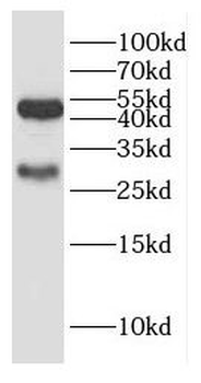 GALC Rabbit Polyclonal Antibody