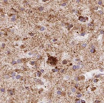 GALC Rabbit Polyclonal Antibody