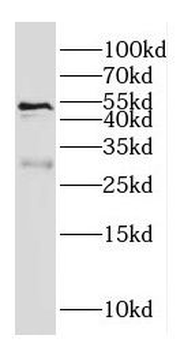 GALC Rabbit Polyclonal Antibody
