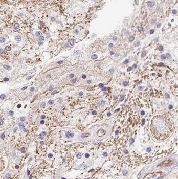 GALC Rabbit Polyclonal Antibody