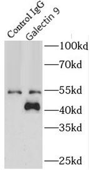 LGALS9 Rabbit Polyclonal Antibody