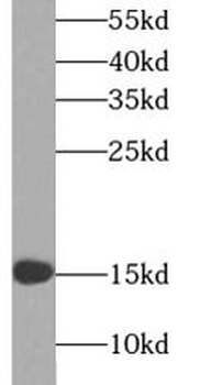 LGALS1 Rabbit Polyclonal Antibody