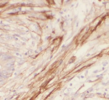 LGALS1 Rabbit Polyclonal Antibody