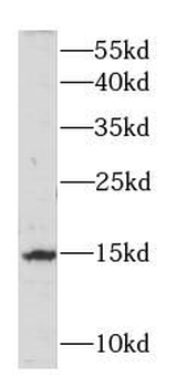 LGALS7 Rabbit Polyclonal Antibody