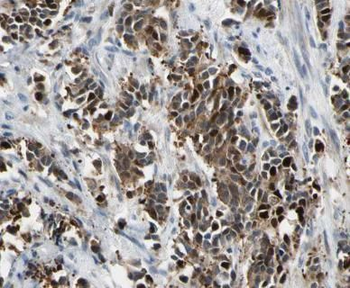 LGALS7 Rabbit Polyclonal Antibody