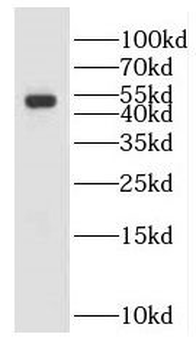 GALK2 Rabbit Polyclonal Antibody
