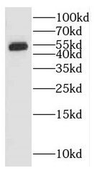 GALNS Rabbit Polyclonal Antibody