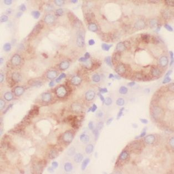 GALNS Rabbit Polyclonal Antibody