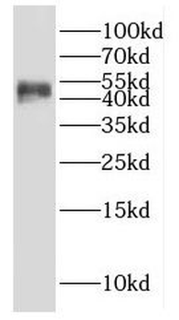 GALT Rabbit Polyclonal Antibody