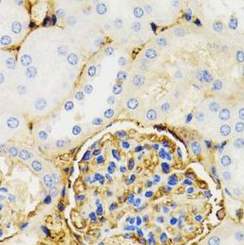 GALT Rabbit Polyclonal Antibody