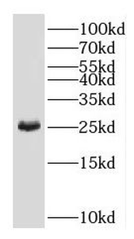 GAMT Rabbit Polyclonal Antibody