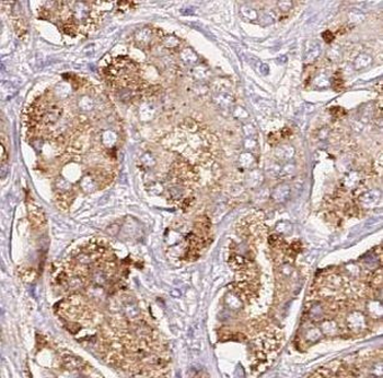 GAMT Rabbit Polyclonal Antibody
