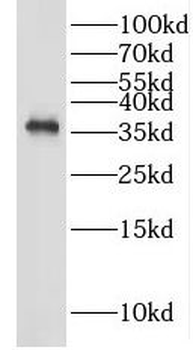 GAS1 Rabbit Polyclonal Antibody