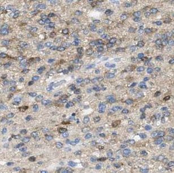 GAS1 Rabbit Polyclonal Antibody